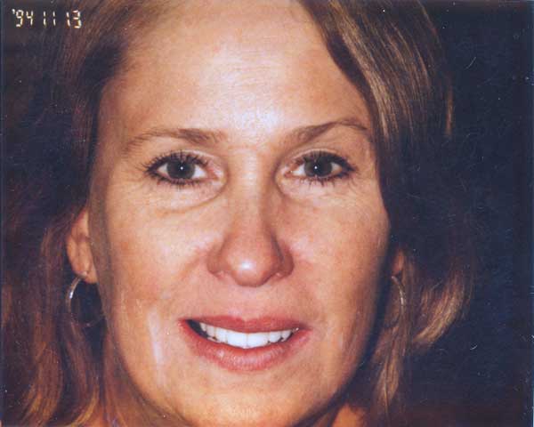 natalie-after
